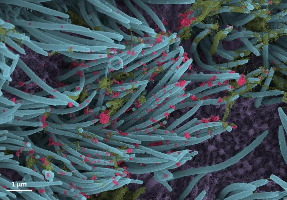 The Weekend Leader - Inhalable dry antiviral powder may be effective against Covid